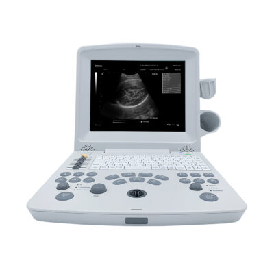 Edan DUS60 Ultrasound